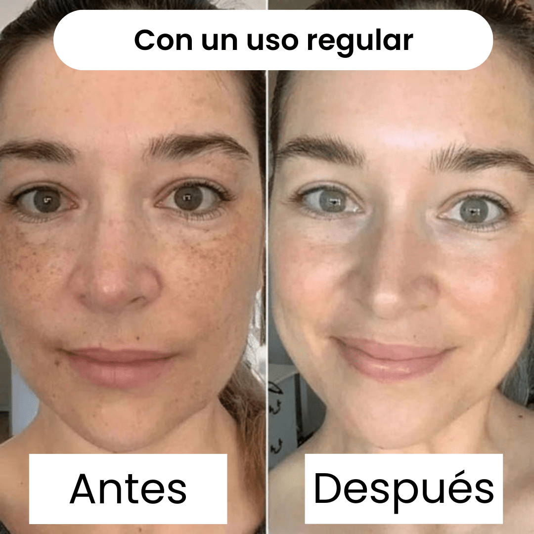 GoldenDream Mask™ — Repara tu Piel mientras Duermes - ClickBooom