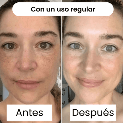 GoldenDream Mask™ — Repara tu Piel mientras Duermes - ClickBooom